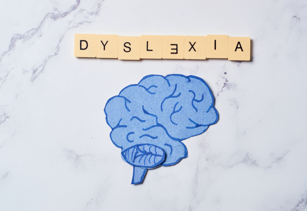 Image of the word dyslexia in scarbble tiles with the E showoing backwards. Below it is a illustration of a brain in blue